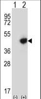 Polyclonal Rabbit anti-Human RMND5B Antibody (aa347-375, IHC, WB)