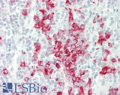 IHC-plus™ Polyclonal Rabbit anti-Human AVEN / PDCD12 Antibody (aa301-350, IHC, WB)