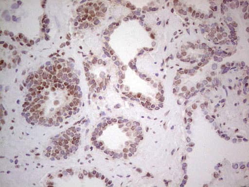 RARA / RAR Alpha Antibody (aa52-299, clone OTI2C3, Carrier-free)