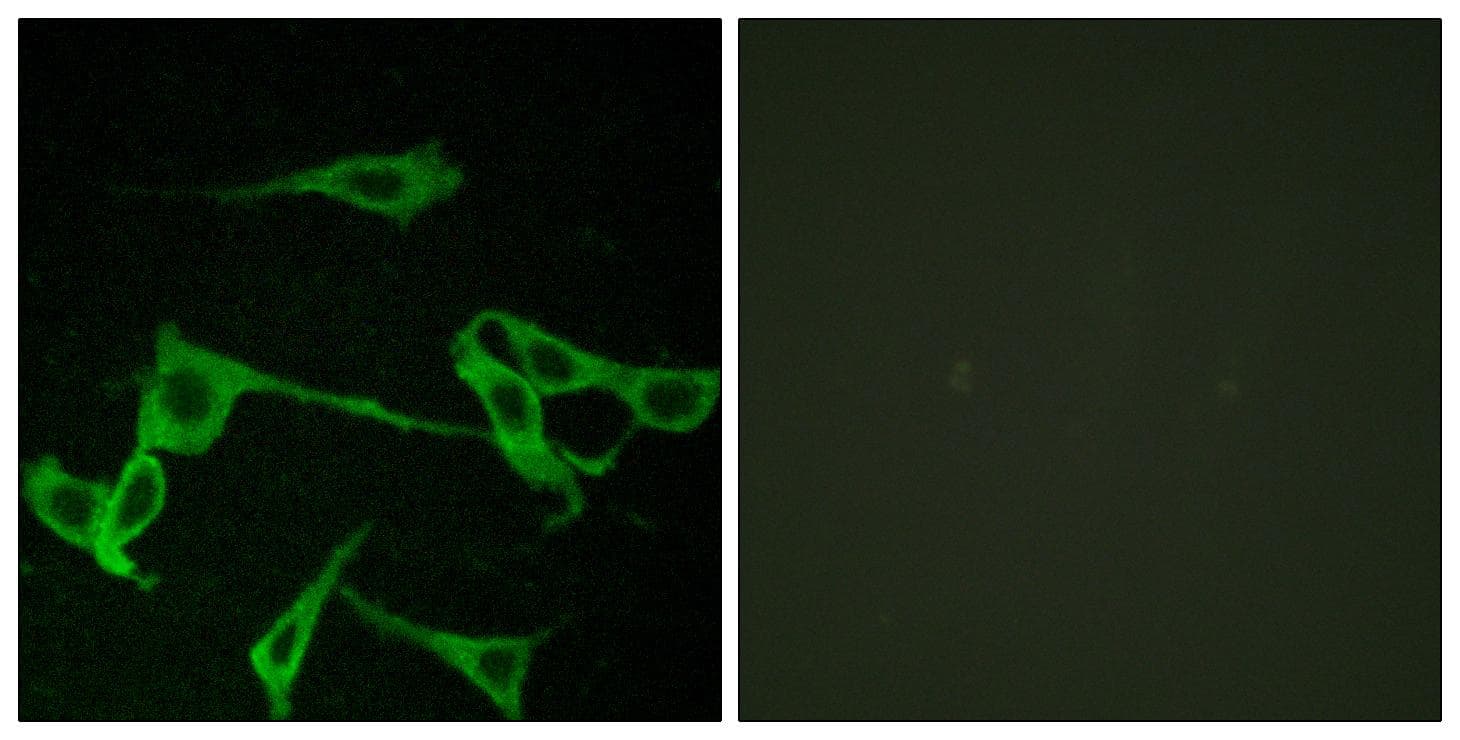 HRH2 / Histamine H2 Receptor Antibody