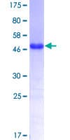 Human TBX3 Protein (Recombinant GST, N-terminus)