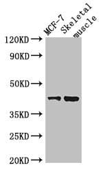 Polyclonal Rabbit anti-Human UBP43 / USP18 Antibody (IHC, IF, WB)
