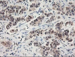ALS2CR1 / NIF3L1 Antibody (clone OTI1F6)