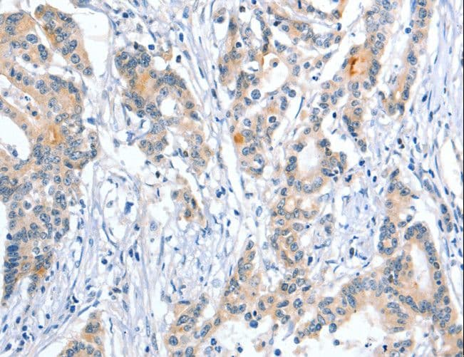 PLAP / Alkaline Phosphatase Antibody
