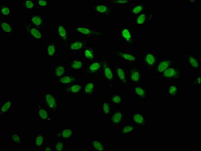 HNRPA1 / HnRNP A1 Antibody