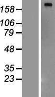 FASN / Fatty Acid Synthase Protein (Over-Expression Lysate Myc-DDK (Flag))