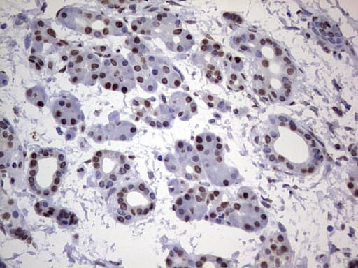 HNRNPL / hnRNP L Antibody (aa270-502, clone OTI9F11, Carrier-free)