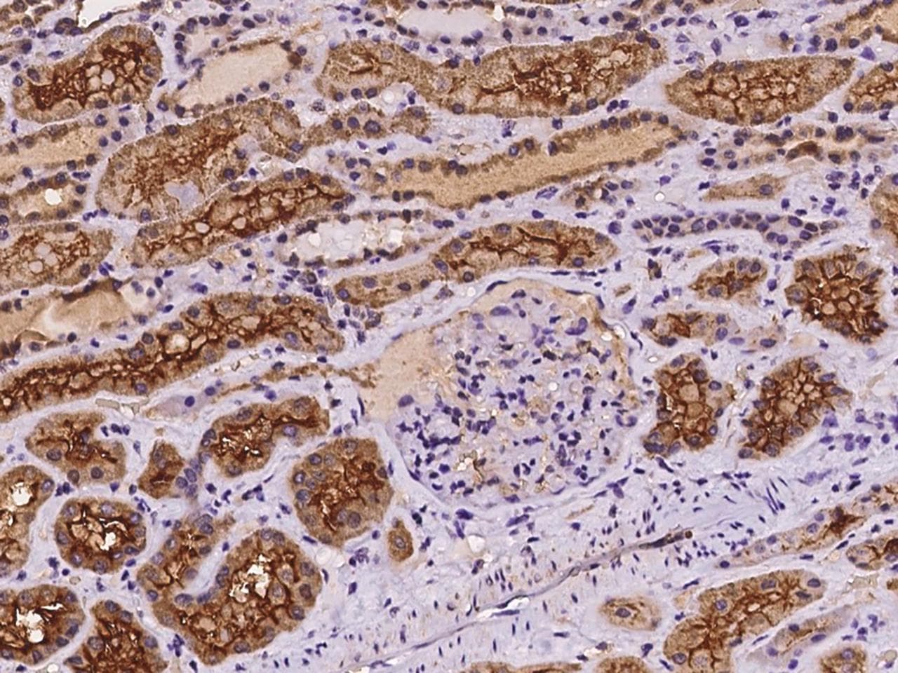 MYO10 / Myosin-X Antibody