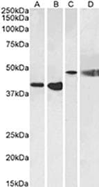 Polyclonal Rabbit anti-Mouse NPY2R Antibody (IHC, WB)