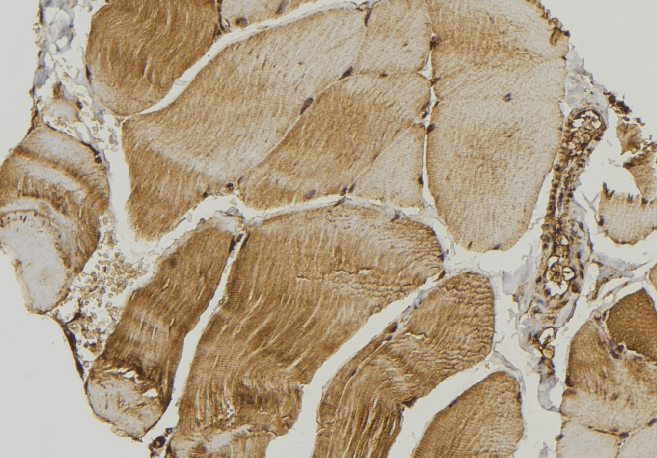 MIEF1 / SMCR7L Antibody
