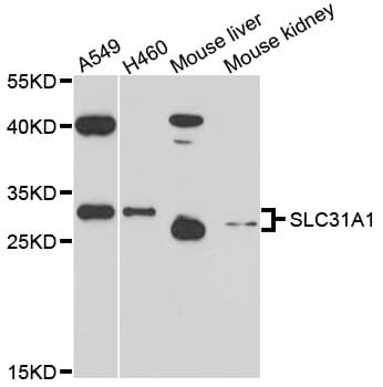 SLC31A1 / CTR1 Antibody