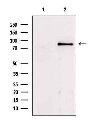 TACC1 Antibody