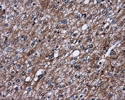 Monoclonal Mouse anti-Human L1CAM Antibody (clone OTI2H5, IHC, IF, WB)
