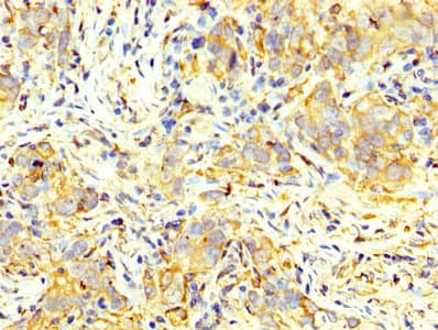 PKM / Pyruvate Kinase, Muscle Antibody