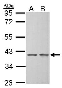 SGTA / SGT Antibody (aa6-313)