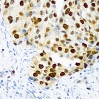 Polyclonal Rabbit anti-Human DDX39B / UAP56 Antibody (IHC, WB)