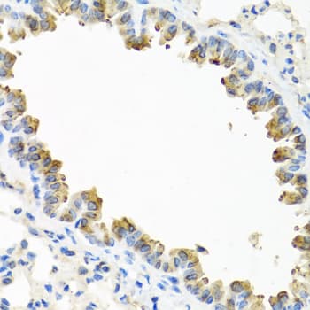 Polyclonal Rabbit anti-Human TICAM1 / TRIF Antibody (IHC, WB)