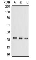 UBC6 / UBE2J2 Antibody