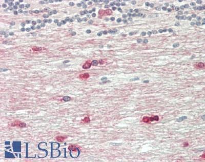 IHC-plus™ ASPA Antibody (aa77-313, clone 3G7)