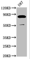 Polyclonal Rabbit anti-Human FRMD7 Antibody (IHC, WB)