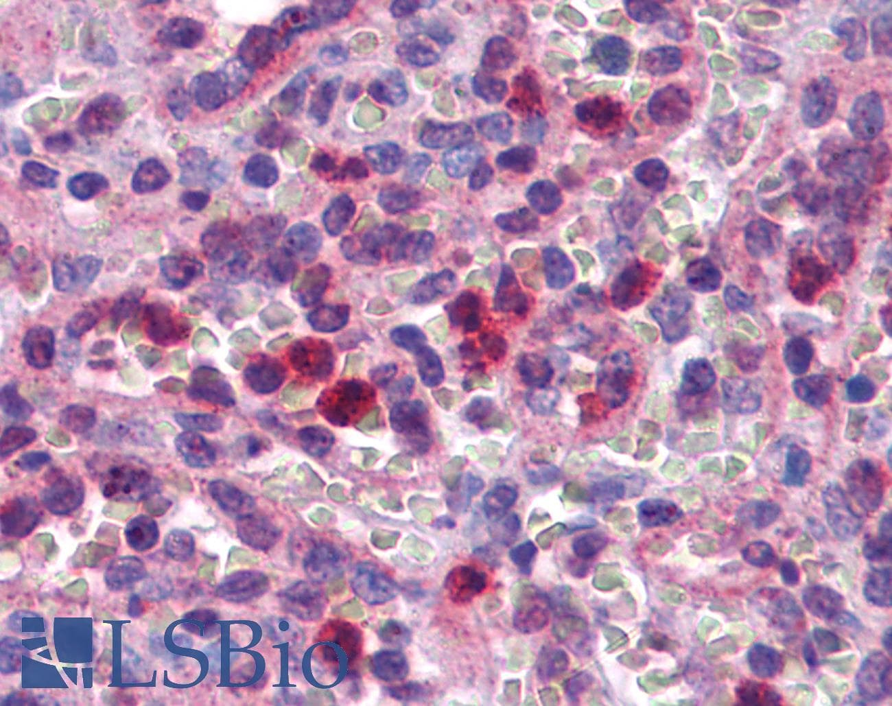 IHC-plus™ Polyclonal Rabbit anti-Human SCRN2 / Ses2 Antibody (IHC, IF, WB)