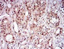 NBN / Nibrin Antibody (aa400-650, clone 7E4A2)