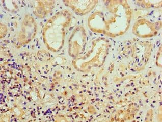 ABH2 / ALKBH2 Antibody (aa1-261)