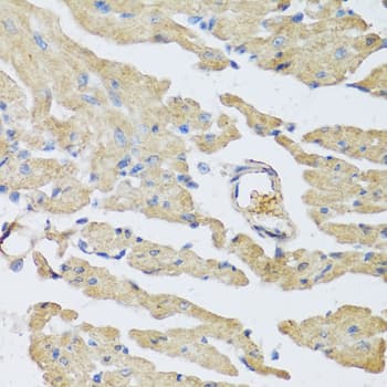 UCN2 / SRP Antibody