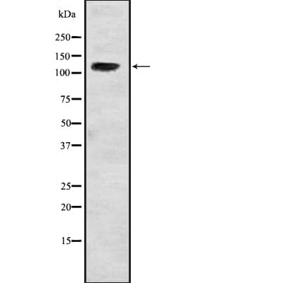 Polyclonal Rabbit anti-Human USP37 Antibody (IHC, WB)
