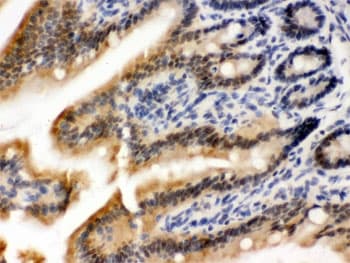 Polyclonal Rabbit anti-Human OGT / O-GLCNAC Antibody (IHC, WB)