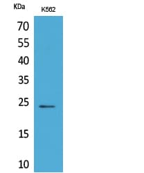 PPIB / Cyclophilin B Antibody