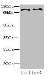 Polyclonal Rabbit anti-Human CCP110 Antibody (IHC, WB)