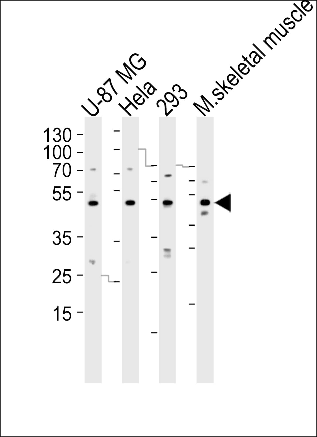 SARS2 / SYS Antibody (aa160-188)