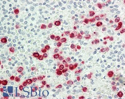 PathPlus™ Monoclonal Mouse anti-Human SSEA-1 / Lewis x / CD15 Antibody (clone AHN1.1, IHC)