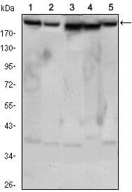 Monoclonal Mouse anti-Human RICTOR Antibody (clone 7B3, IHC, IF, WB)