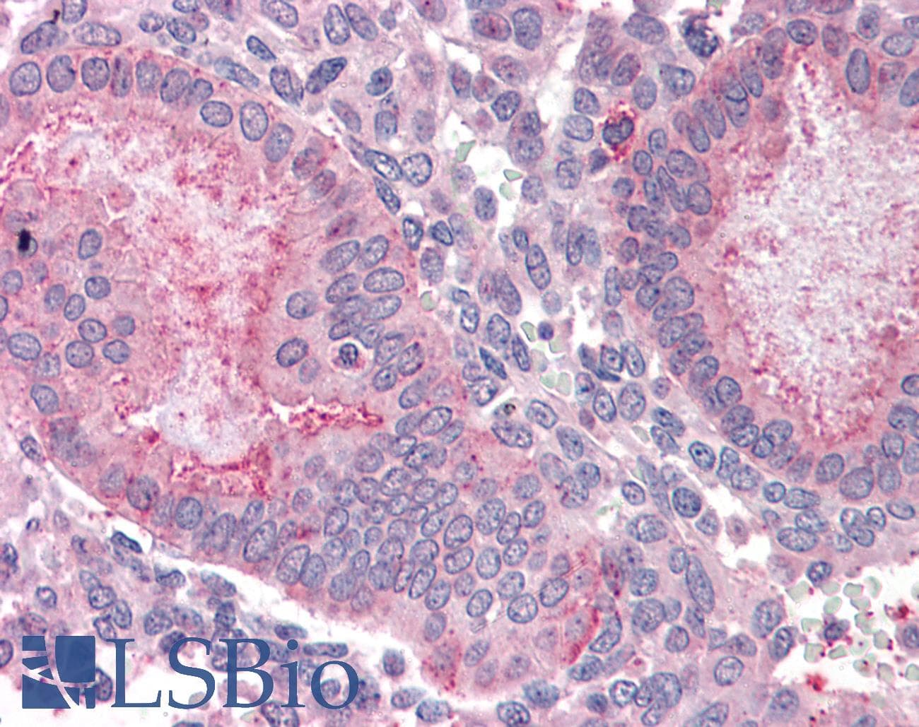 IHC-plus™ Polyclonal Rabbit anti-Human OLFM4 / Olfactomedin 4 Antibody (Internal, IHC)