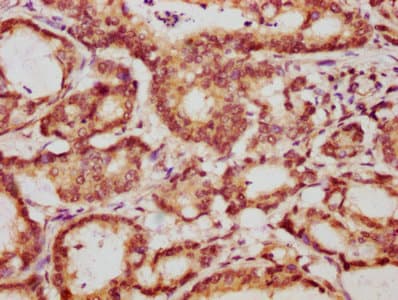 YWHAE / 14-3-3 Epsilon Antibody