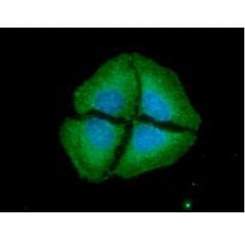 IHC-plus™ NT5E / eNT / CD73 Antibody (aa27-252, clone 2B6)