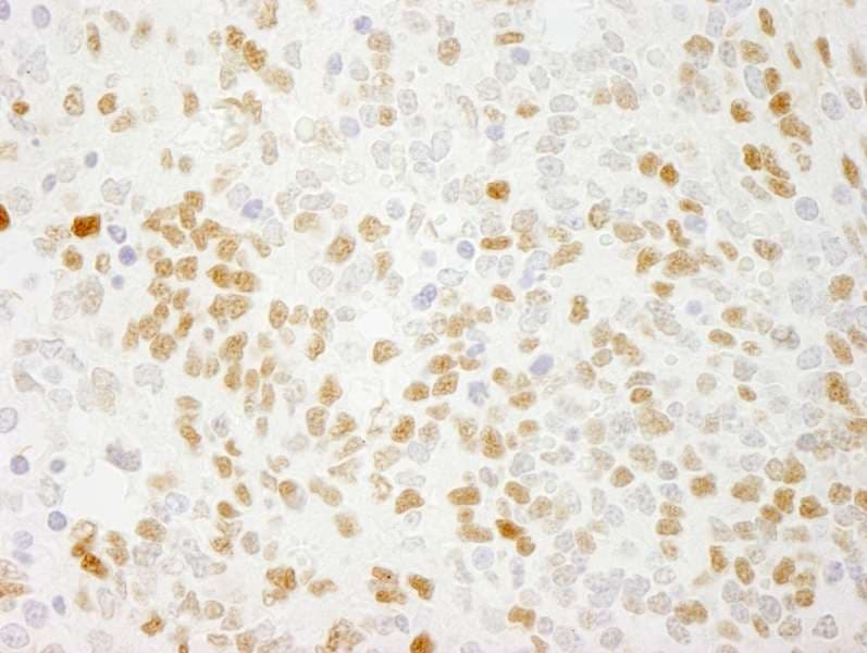 QKI Antibody (C-Terminus)
