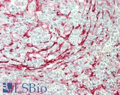 IHC-plus™ Monoclonal Mouse anti-Human TMEM173 / STING Antibody (clone 1A7, IHC, WB)