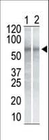 IHC-plus™ Monoclonal Mouse anti-Human CHEK1 / CHK1 Antibody (clone 2G1D5, IHC, WB)