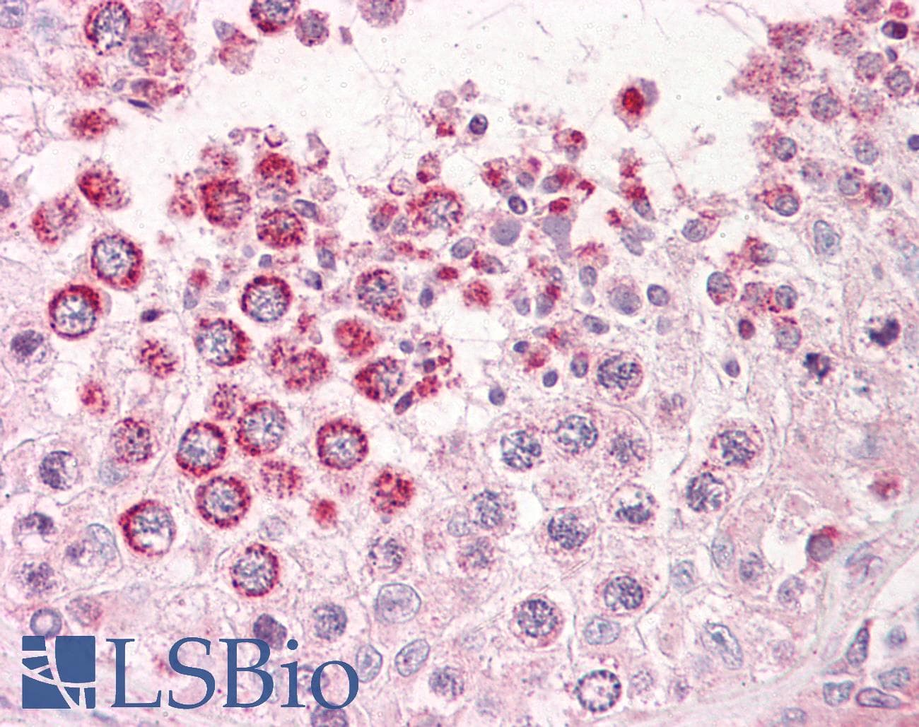 IHC-plus™ XAGE1E Antibody (aa58-69)