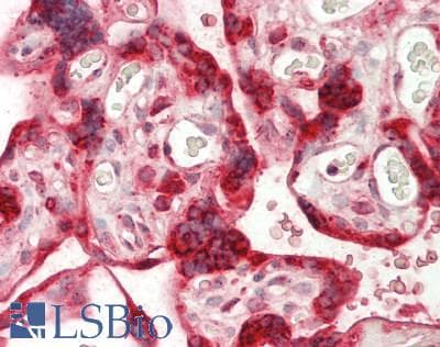IHC-plus™ IFNAR2 Antibody