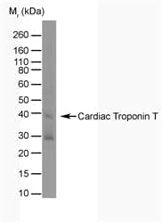 TNNT2 / CTNT Antibody (clone TT44 (BGN/1288/44))