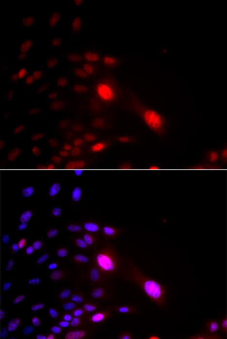 Polyclonal Rabbit anti-Human DDB2 Antibody (IHC, IF, WB)