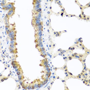 C8orf4 Antibody