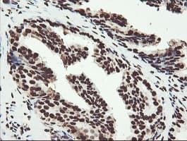 Monoclonal Mouse anti-Human NONO / P54NRB Antibody (clone OTI2E7, IHC, WB)
