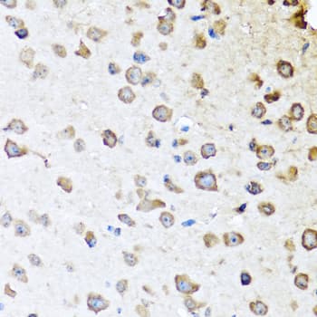 SERPINA10 / PZI Antibody