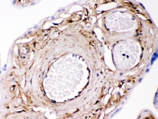 Polyclonal Rabbit anti-Human LGALS1 / Galectin 1 Antibody (IHC, WB)