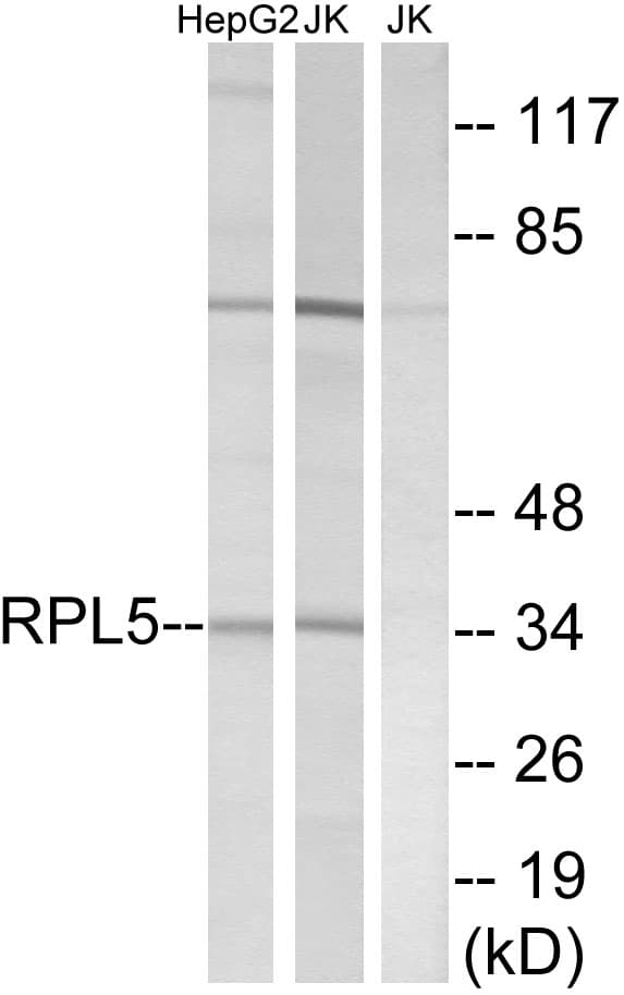 RPL5 / Ribosomal Protein L5 Antibody (aa161-210)